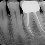 dental x-ray 2